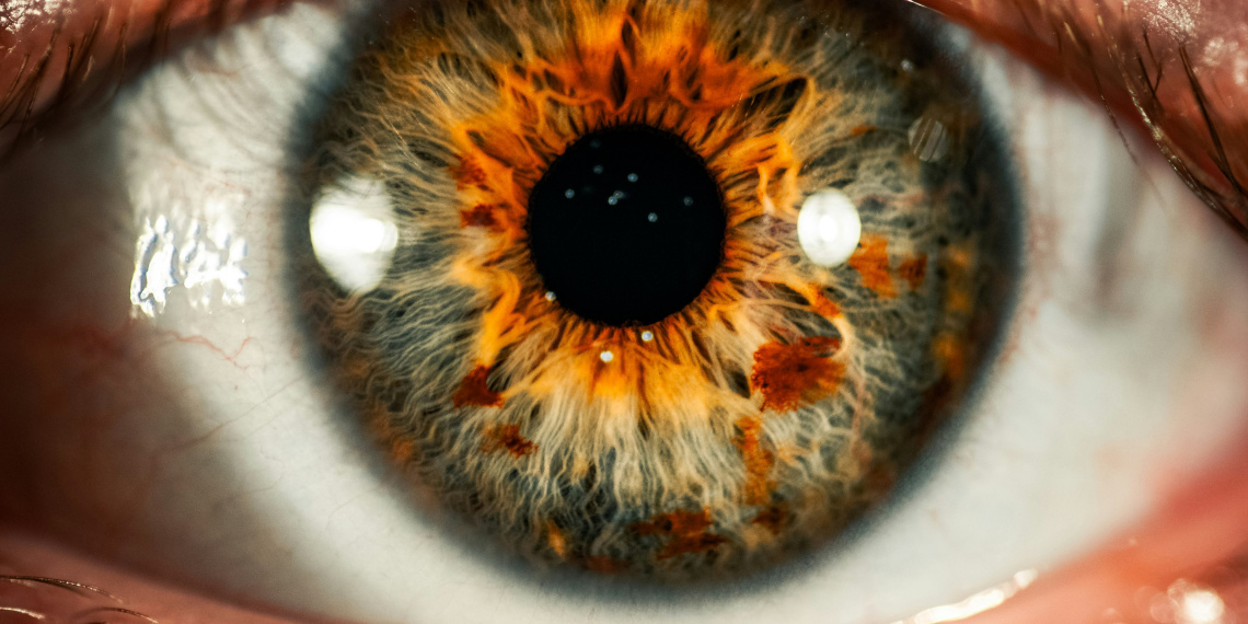 Photographie d'un œil en gros plan, avec l'iris allant du jaune au bleu-vert-gris