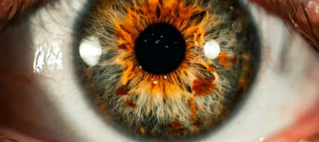 Photographie d'un œil en gros plan, avec l'iris allant du jaune au bleu-vert-gris